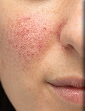 Μαρία, 27 ετών