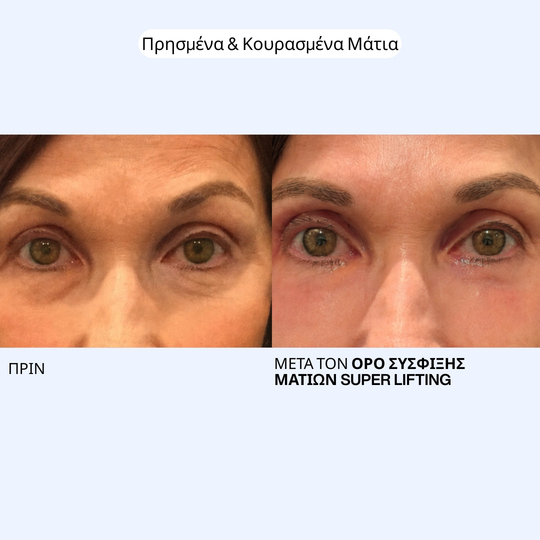 Ορός Σύσφιξης Ματιών Super Lifting Labbok - Ρυτίδες & Χαλάρωση, Άμεσο Λίφτινγκ σε 30 Λεπτά