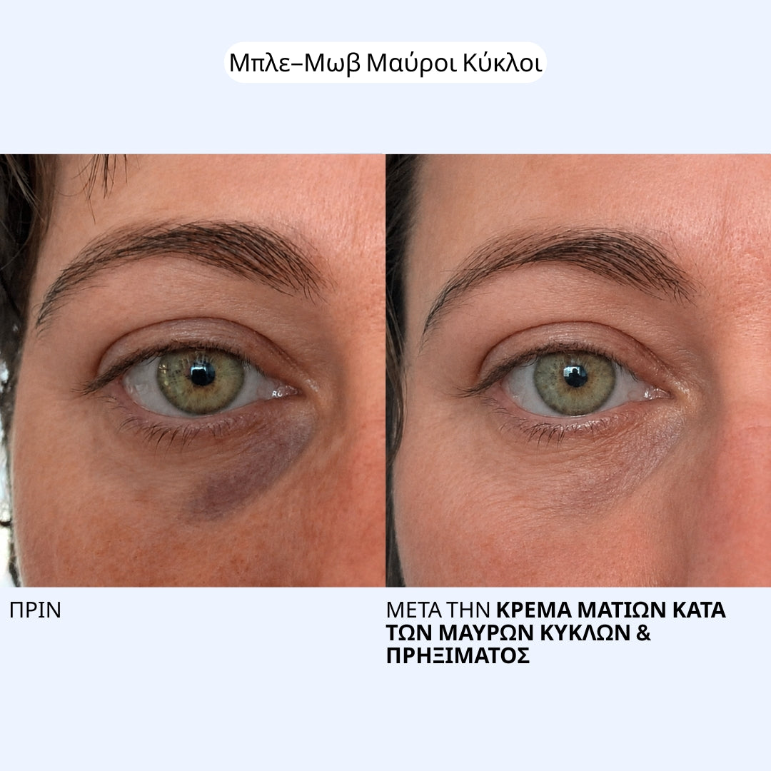 Κρέμα Ματιών κατά των Μαύρων Κύκλων & Πρηξίματος Labbok - Ξεκούραστο Βλέμμα από το Πρώτο Πρωί 20ml