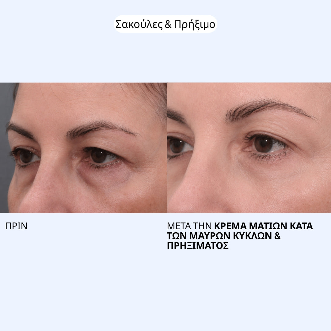 Κρέμα Ματιών κατά των Μαύρων Κύκλων & Πρηξίματος Labbok - Ξεκούραστο Βλέμμα από το Πρώτο Πρωί 20ml