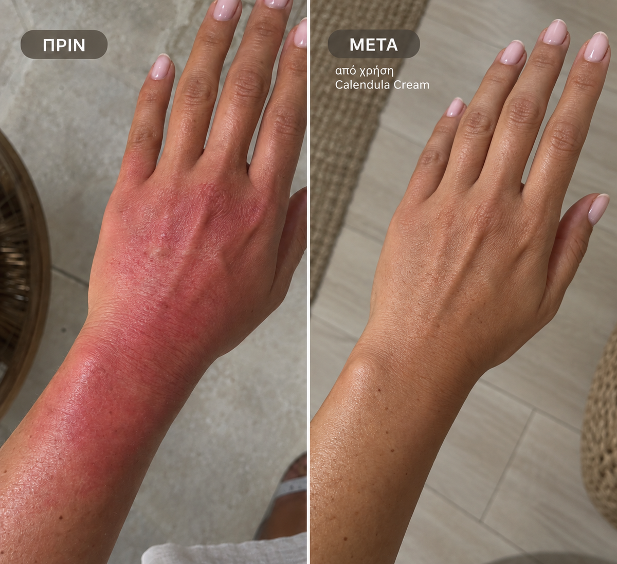 Labbok Rescue Cream After Laser & After Sun 100ml