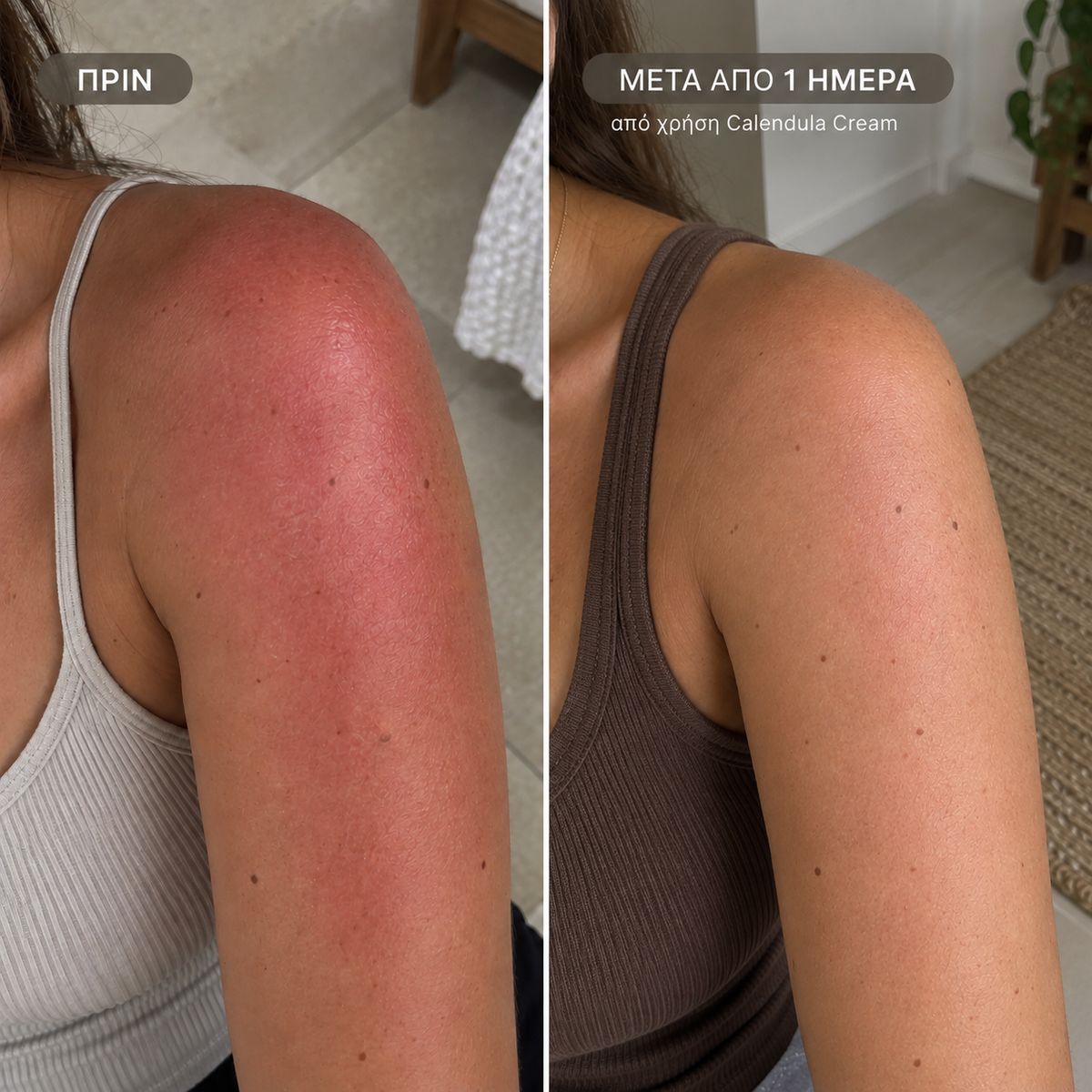 Labbok Rescue Cream After Laser & After Sun 100ml