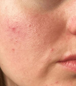 Ιωάννα, 34 ετών